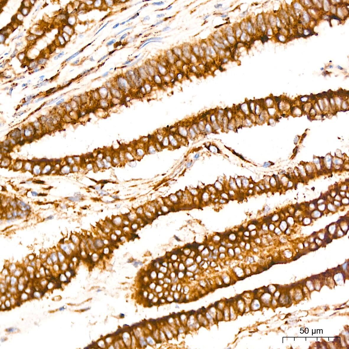 Peroxiredoxin 4 Antibody (9E7V0)