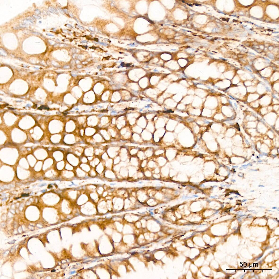 Peroxiredoxin 4 Antibody (9E7V0)