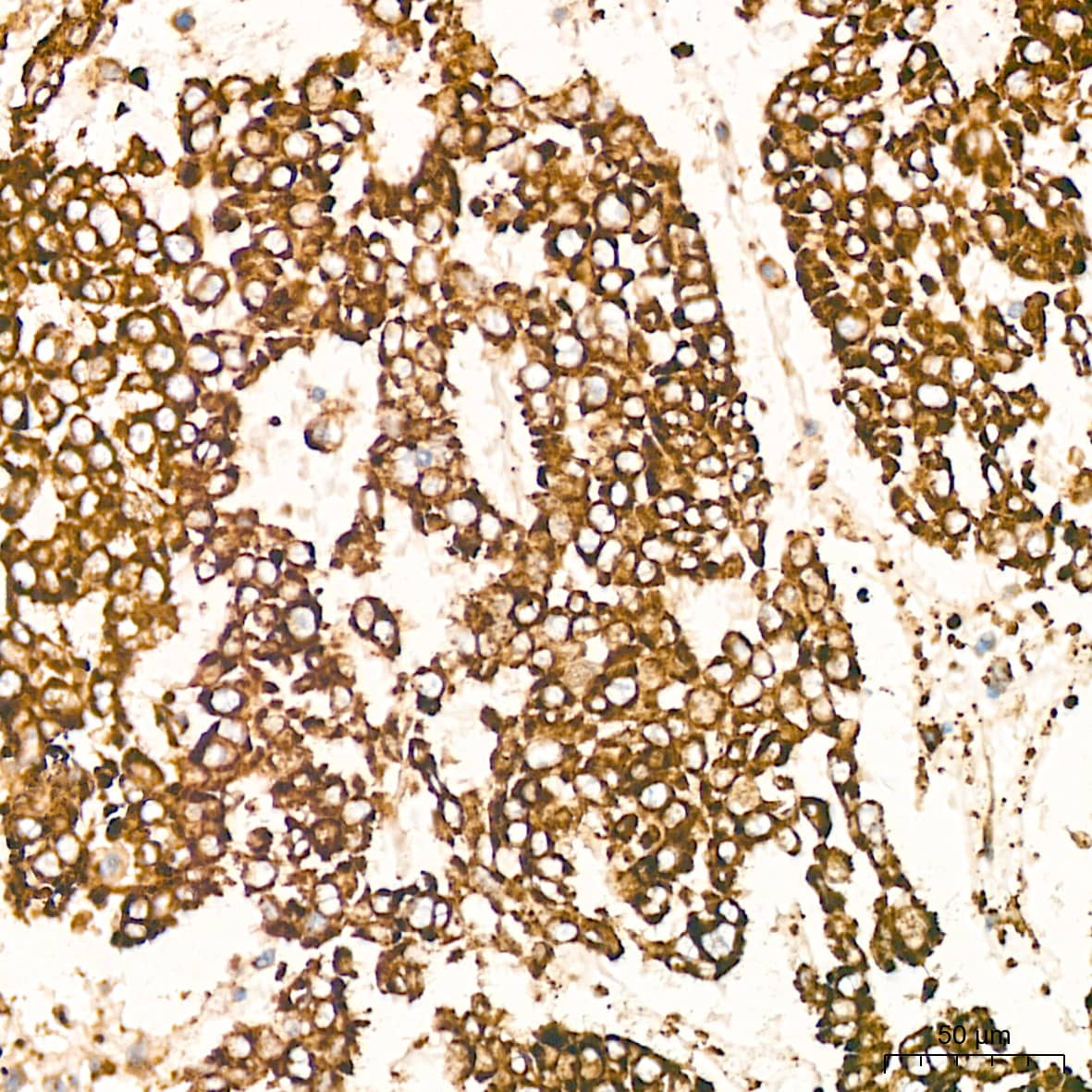 Peroxiredoxin 4 Antibody (9E7V0)