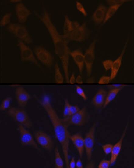 ABCE1 Antibody (1N4I7)