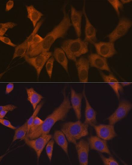 EIF3B Antibody (4T9V1)