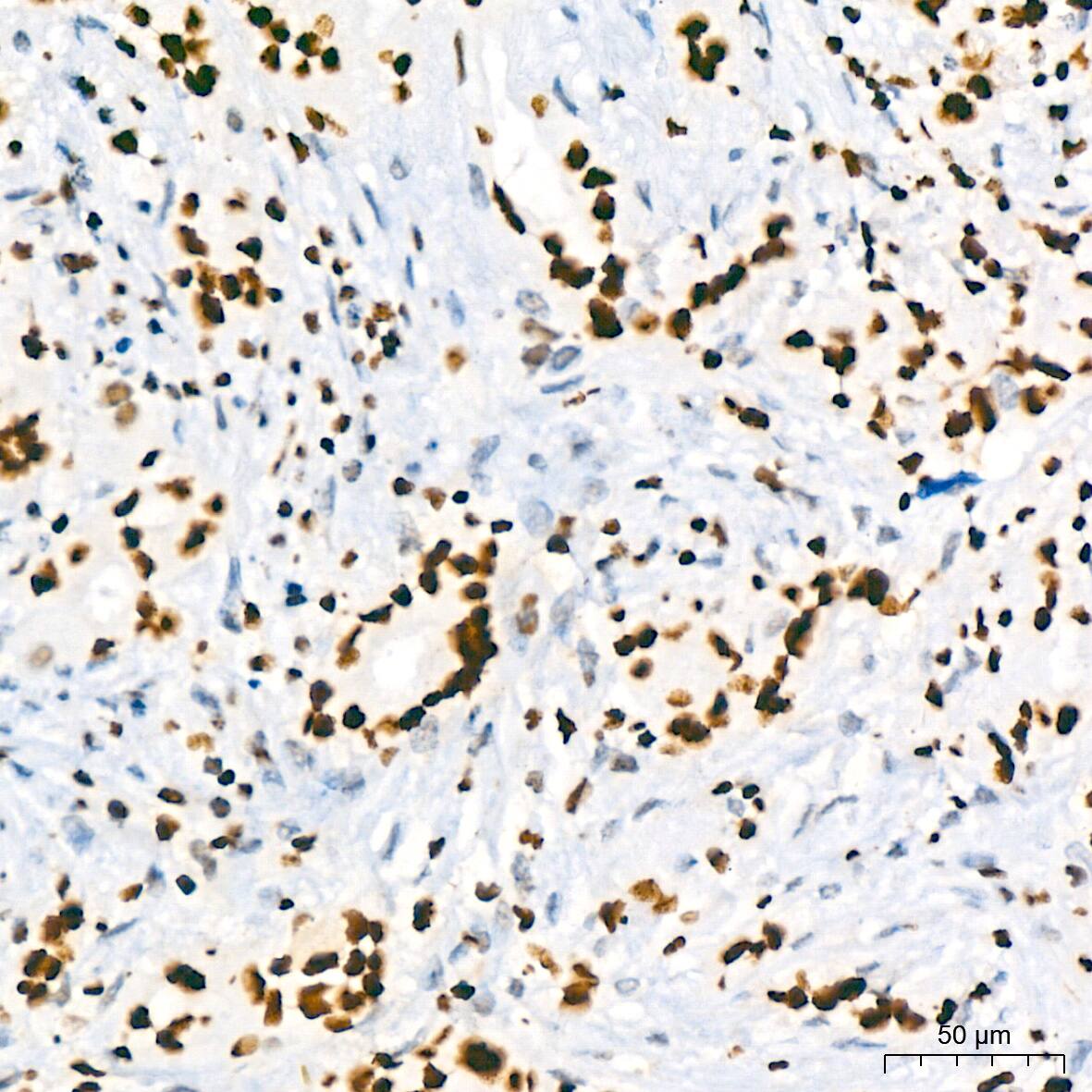 HMGB2 Antibody (8P10V5)
