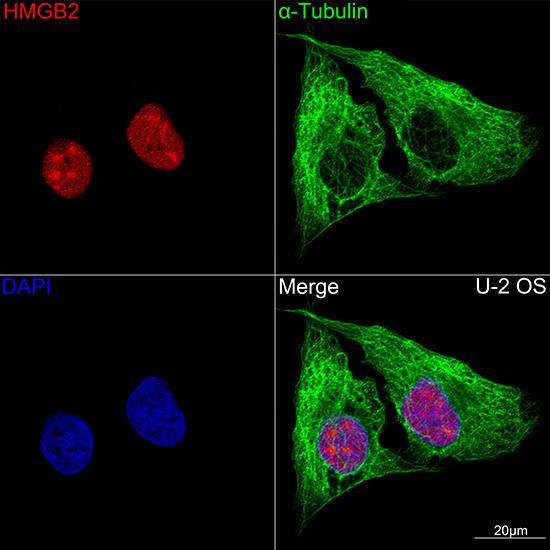 HMGB2 Antibody (8P10V5)