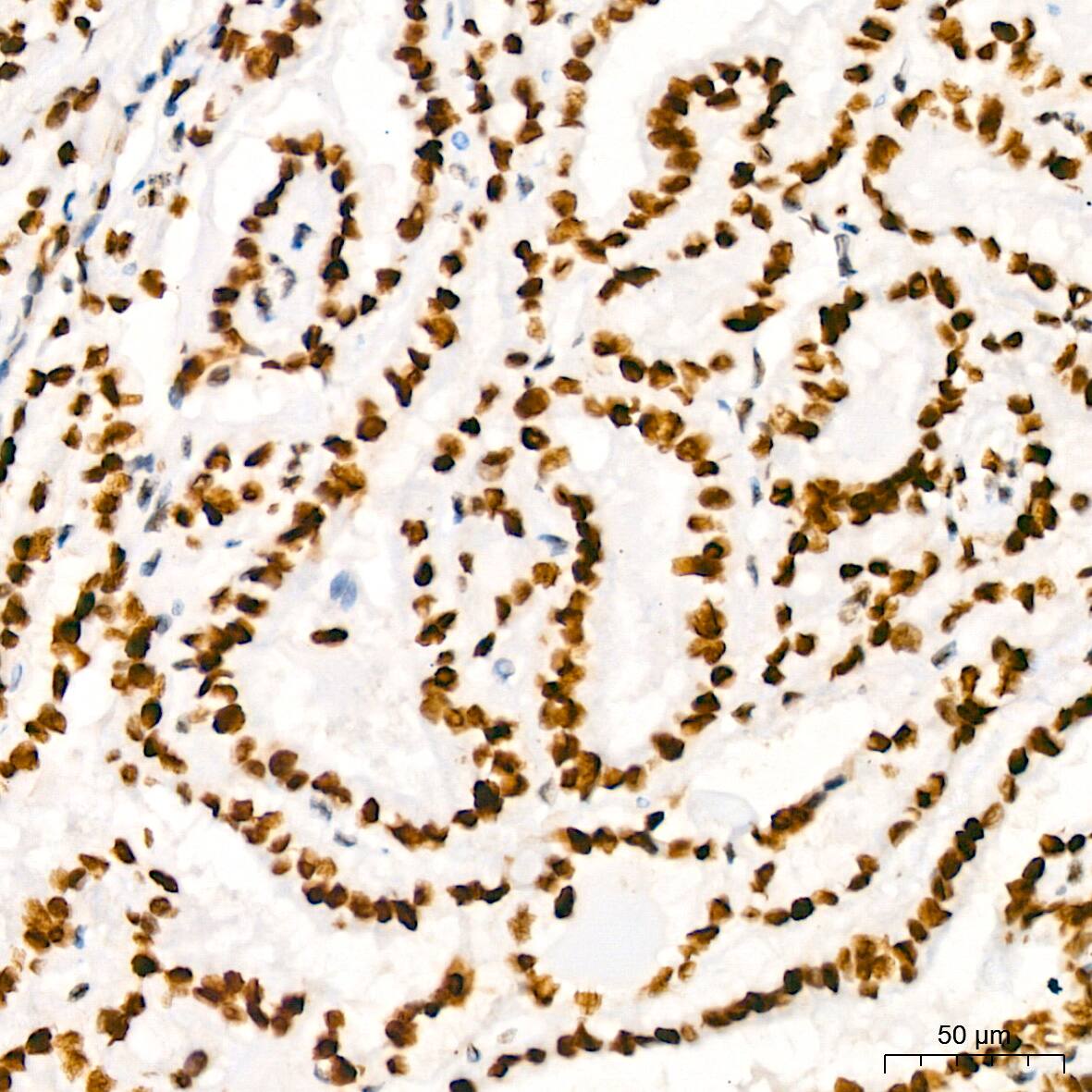 HMGB2 Antibody (8P10V5)