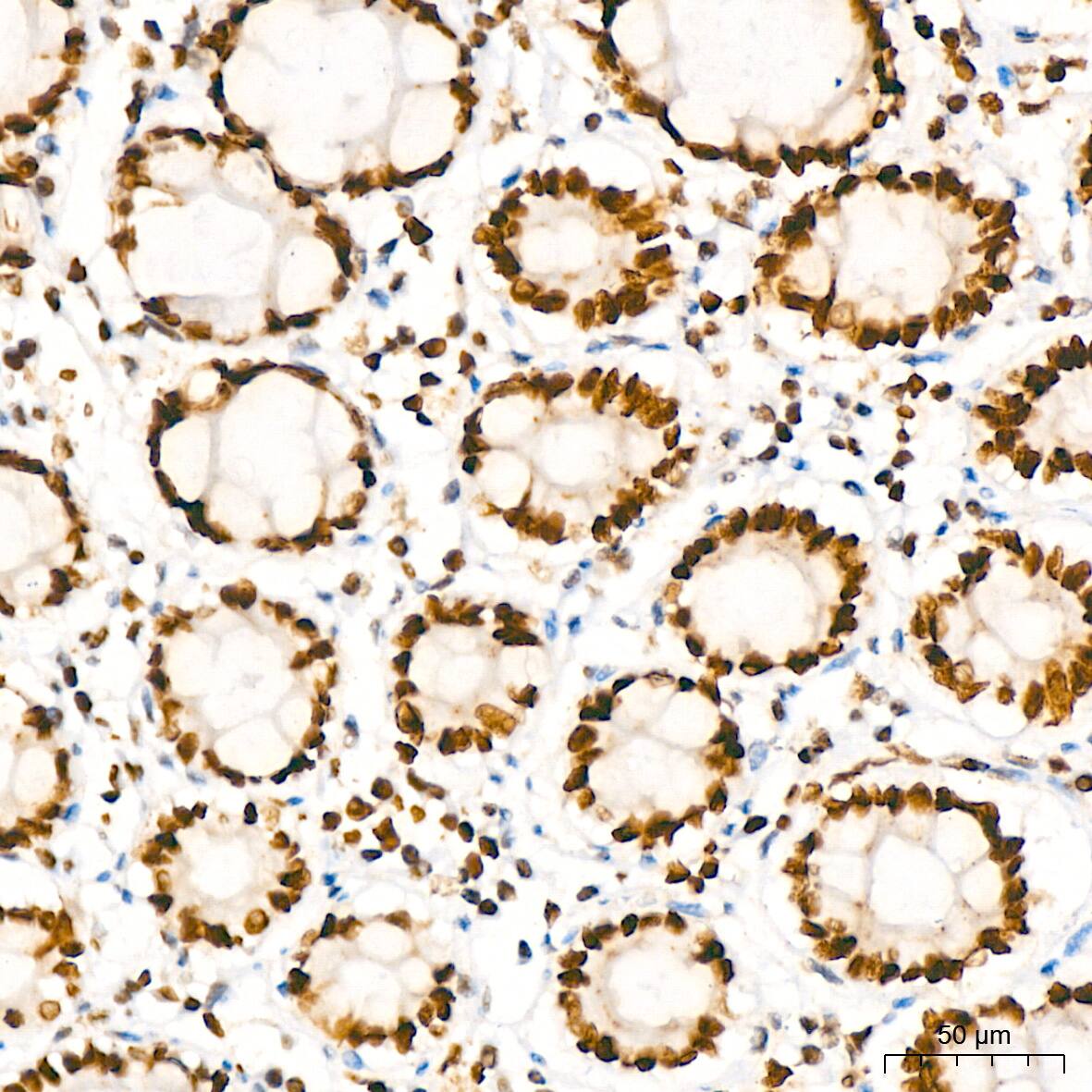 HMGB2 Antibody (8P10V5)
