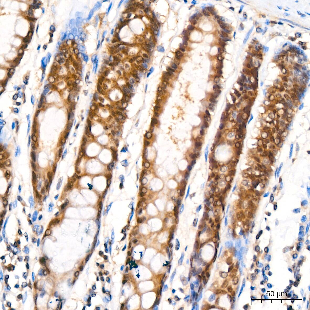 PSMA2 Antibody (6L5H4)
