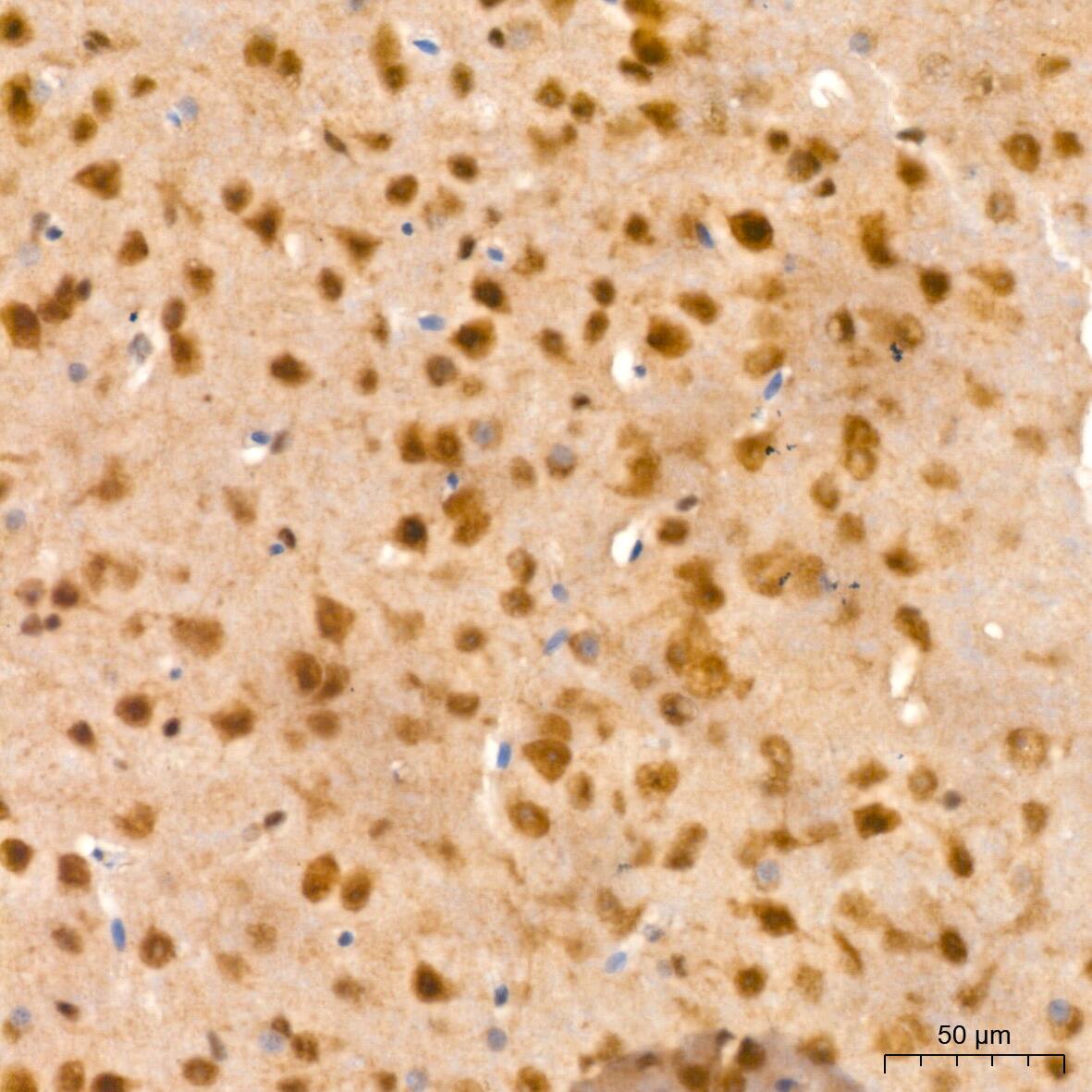 PSMA2 Antibody (6L5H4)