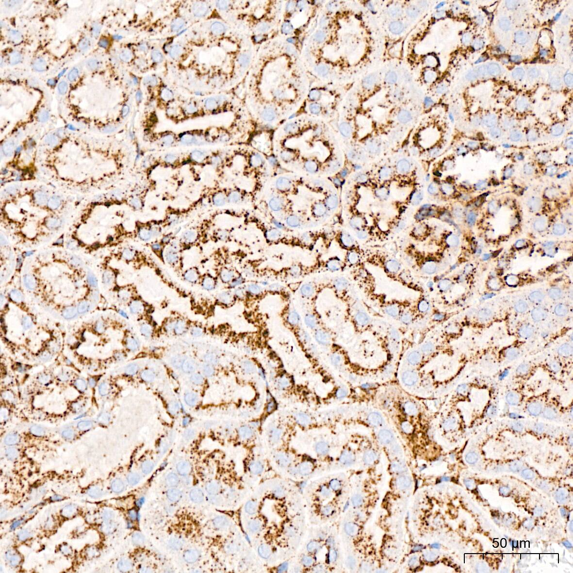 LIMPII/SR-B2 Antibody (7D2P5)