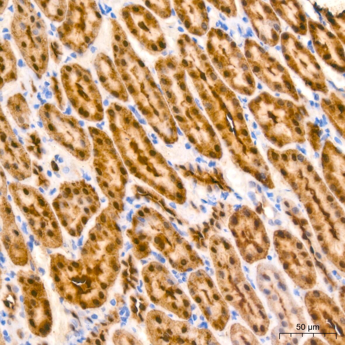 ABH1 Antibody (5K4W5)