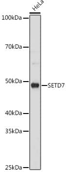 SETD7 Antibody (7Z6I8)