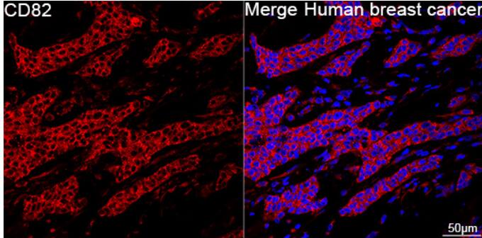 CD82/Kai-1 Antibody (0T3L6)