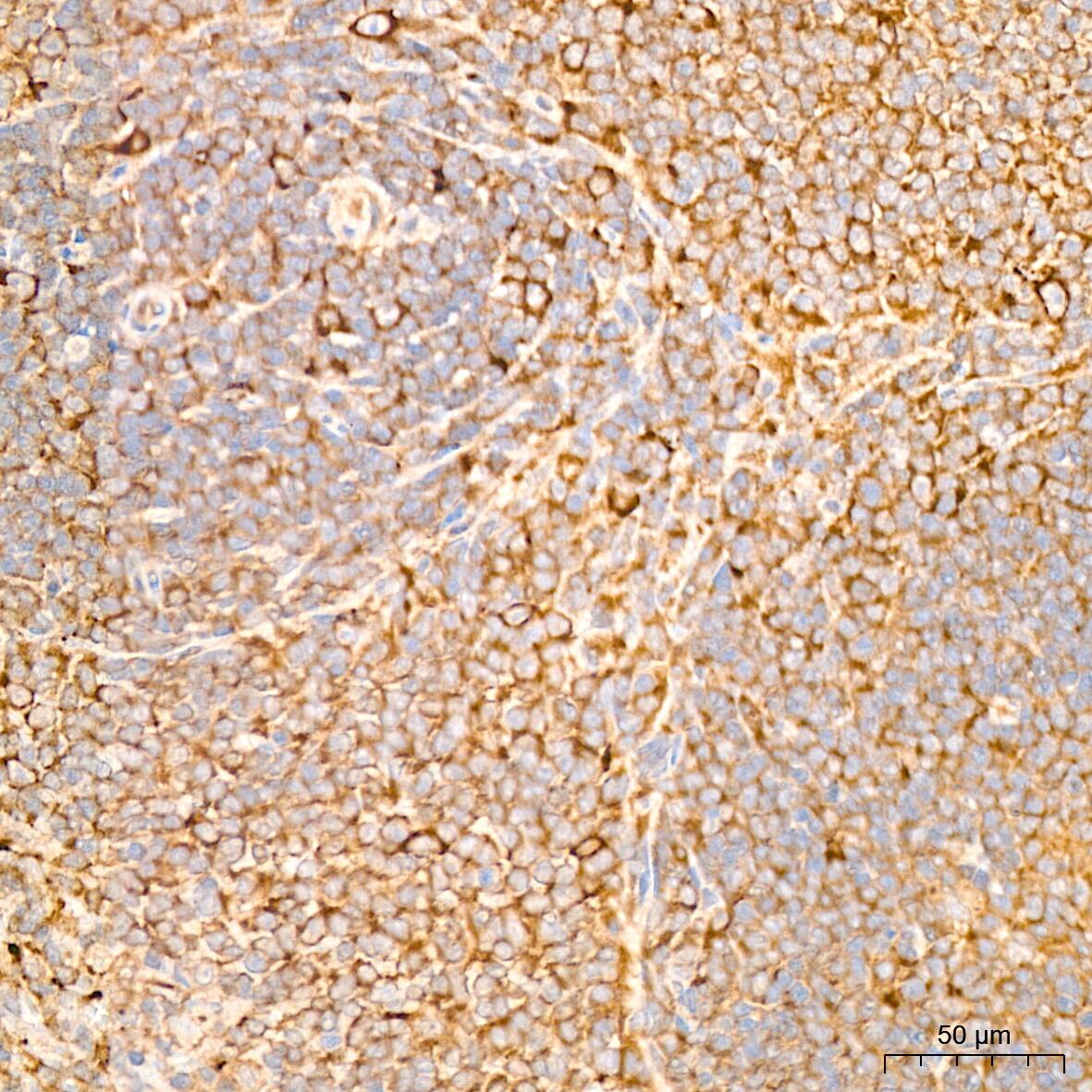 IL-11R alpha Antibody (10Z3S9)