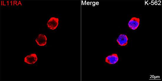IL-11R alpha Antibody (10Z3S9)