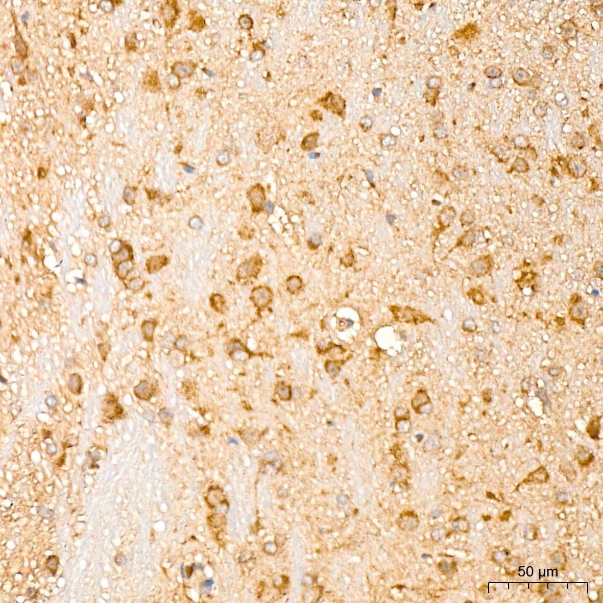 IL-11R alpha Antibody (10Z3S9)
