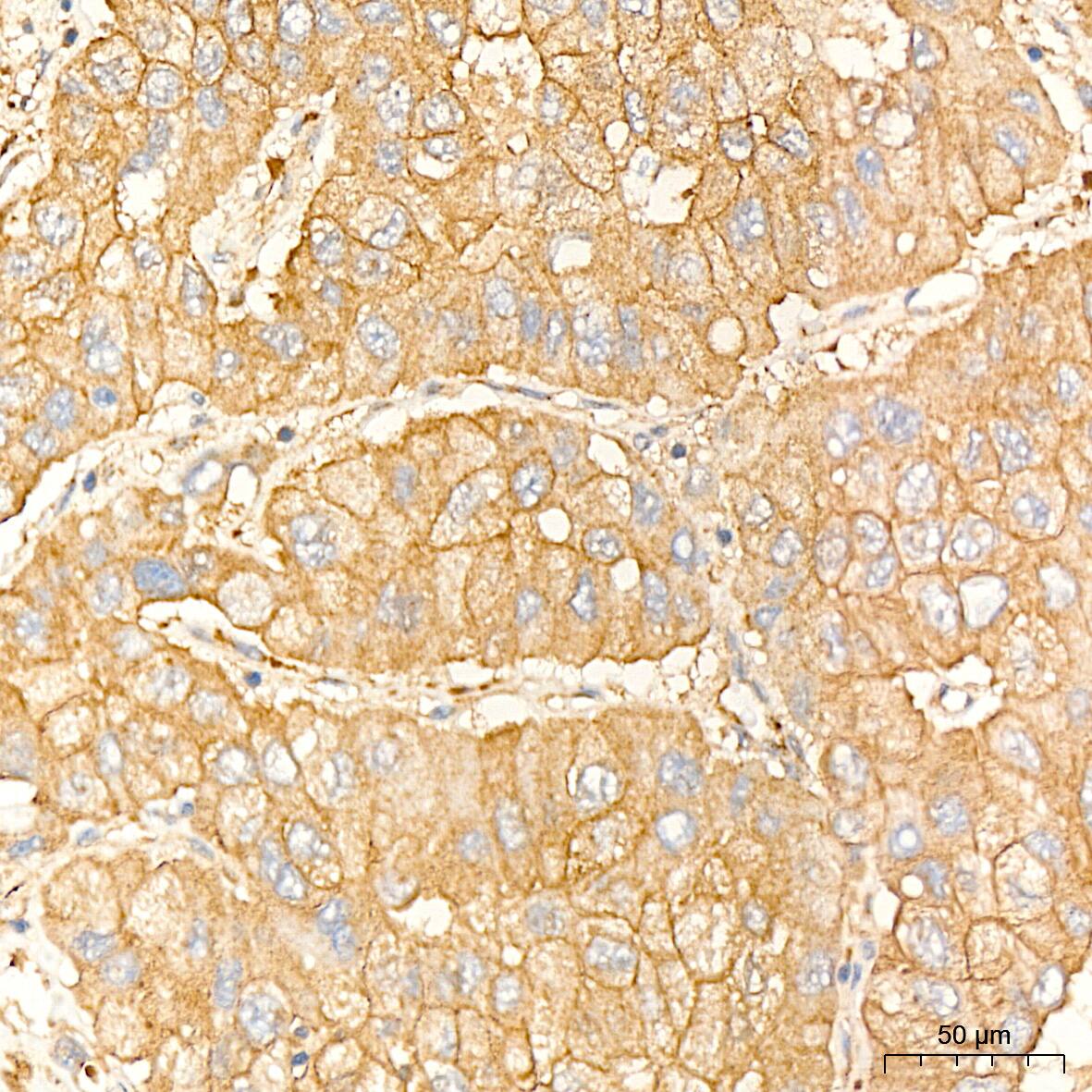 IL-11R alpha Antibody (10Z3S9)