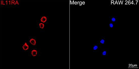 IL-11R alpha Antibody (10Z3S9)