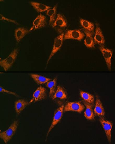 UQCRFS1 Antibody (0O9Z10)