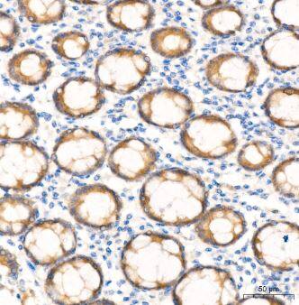 Cortactin Antibody (2W5H9)