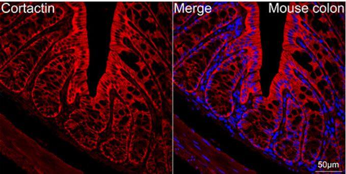Cortactin Antibody (2W5H9)