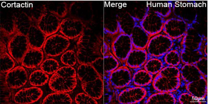 Cortactin Antibody (2W5H9)