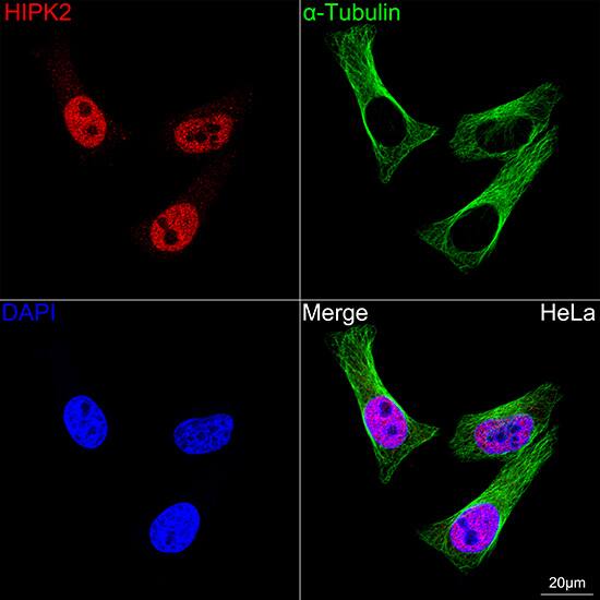 HIPK2 Antibody (3Z5P6)