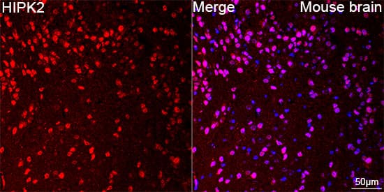 HIPK2 Antibody (3Z5P6)