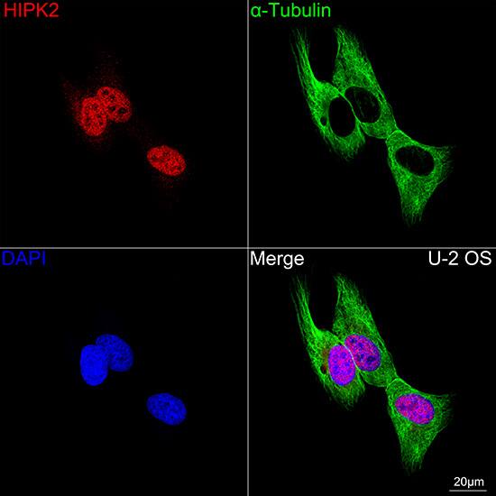 HIPK2 Antibody (3Z5P6)