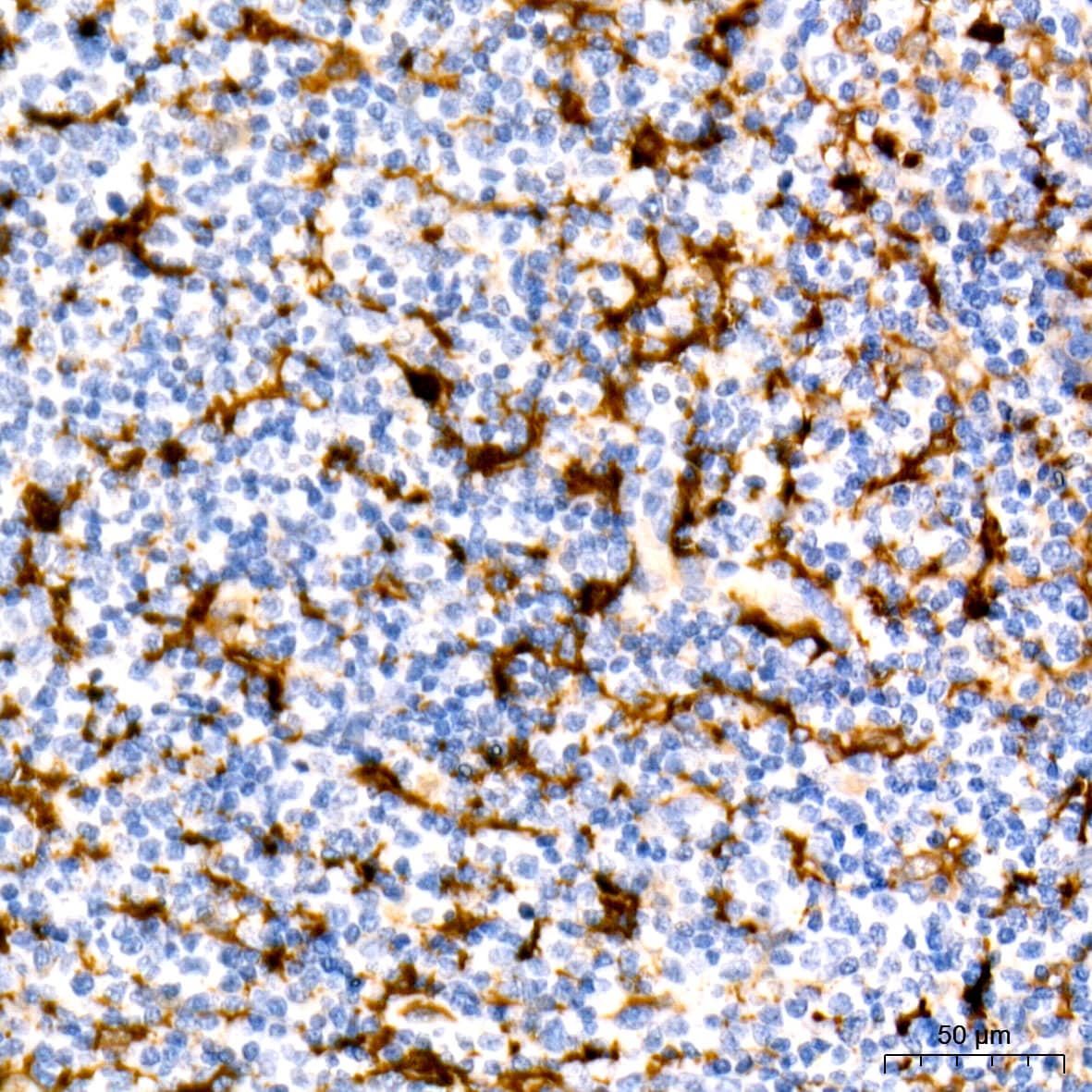Fascin Antibody (1B3V6)