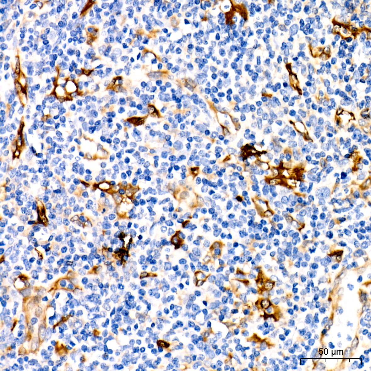 Fascin Antibody (1B3V6)
