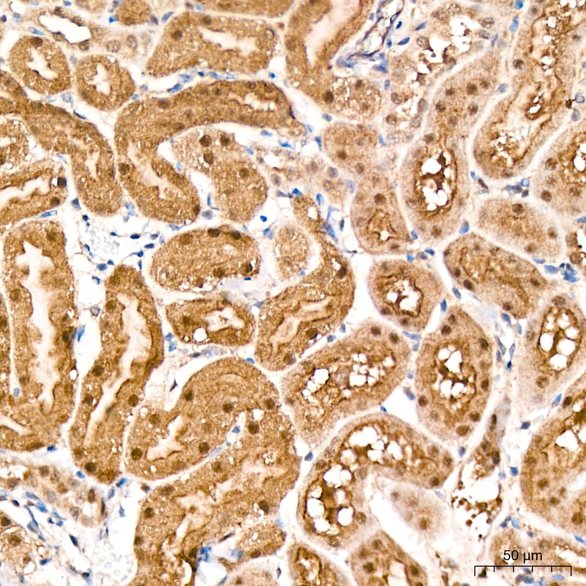 PSMD14 Antibody (5V0H3)