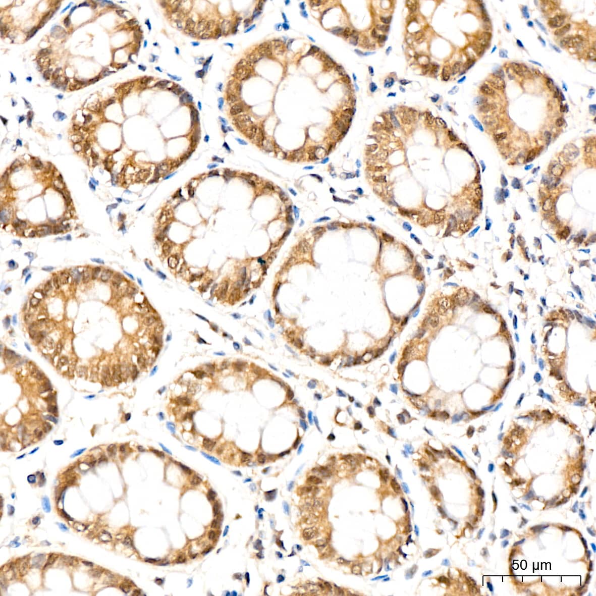 PSMD14 Antibody (5V0H3)