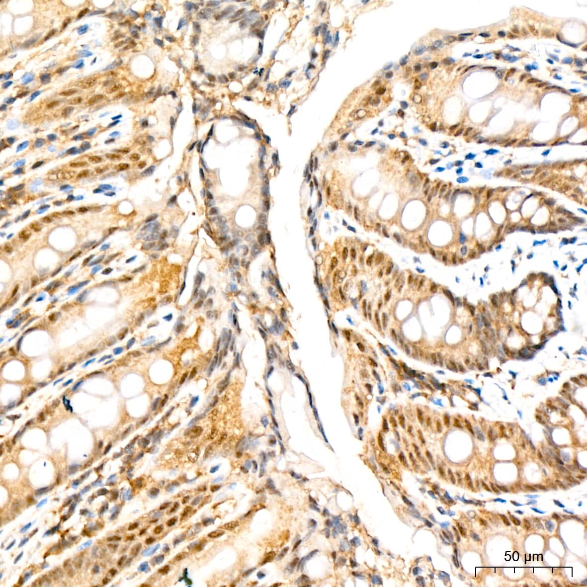 PSMD14 Antibody (5V0H3)