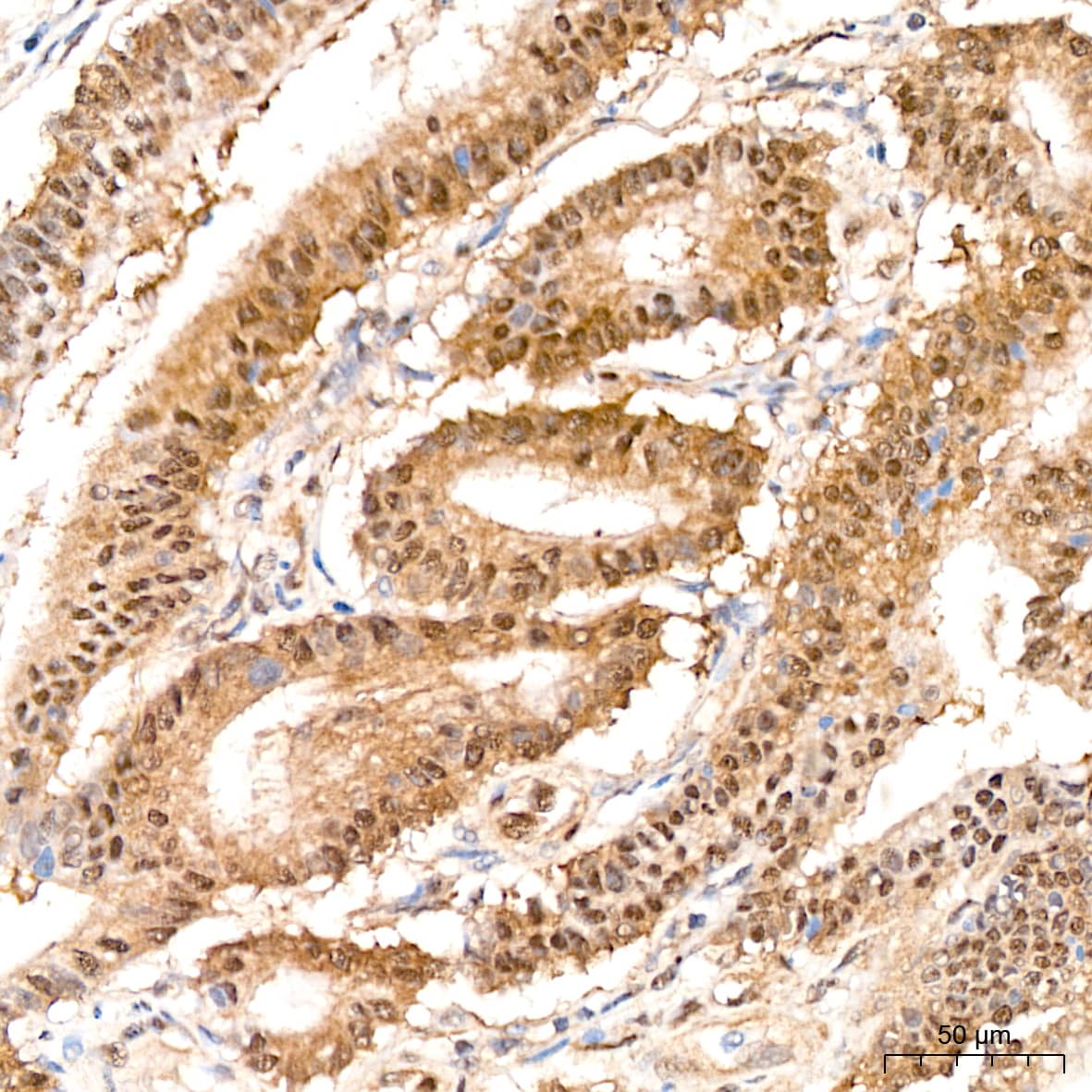 PSMD14 Antibody (5V0H3)