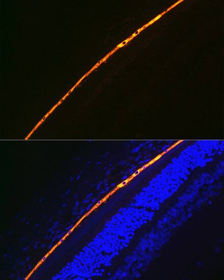 RPE65 Antibody (5X1F6)