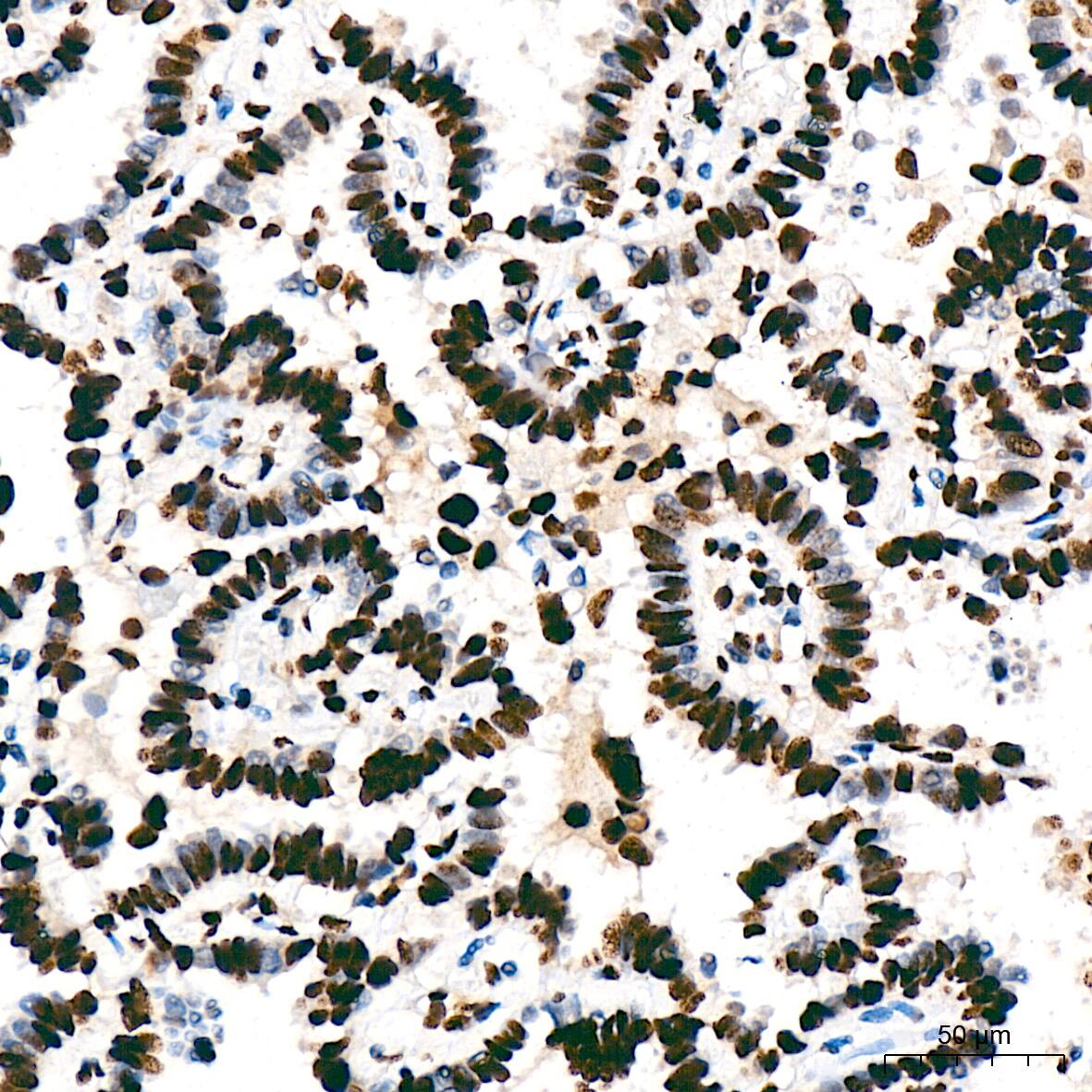 SAP130 Antibody (3K1X4)