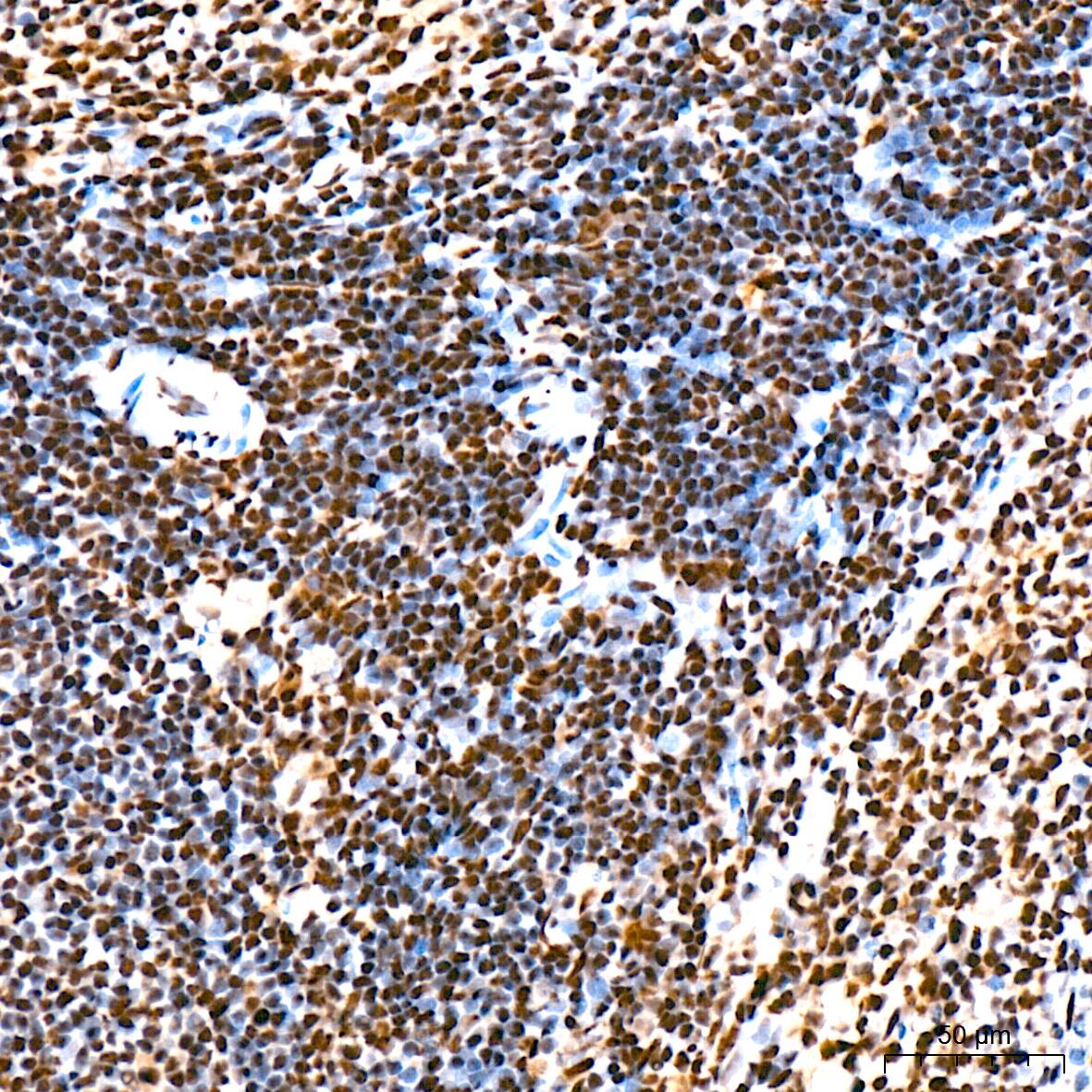 SAP130 Antibody (3K1X4)