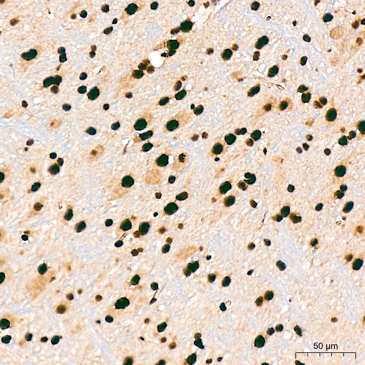 SAP130 Antibody (3K1X4)
