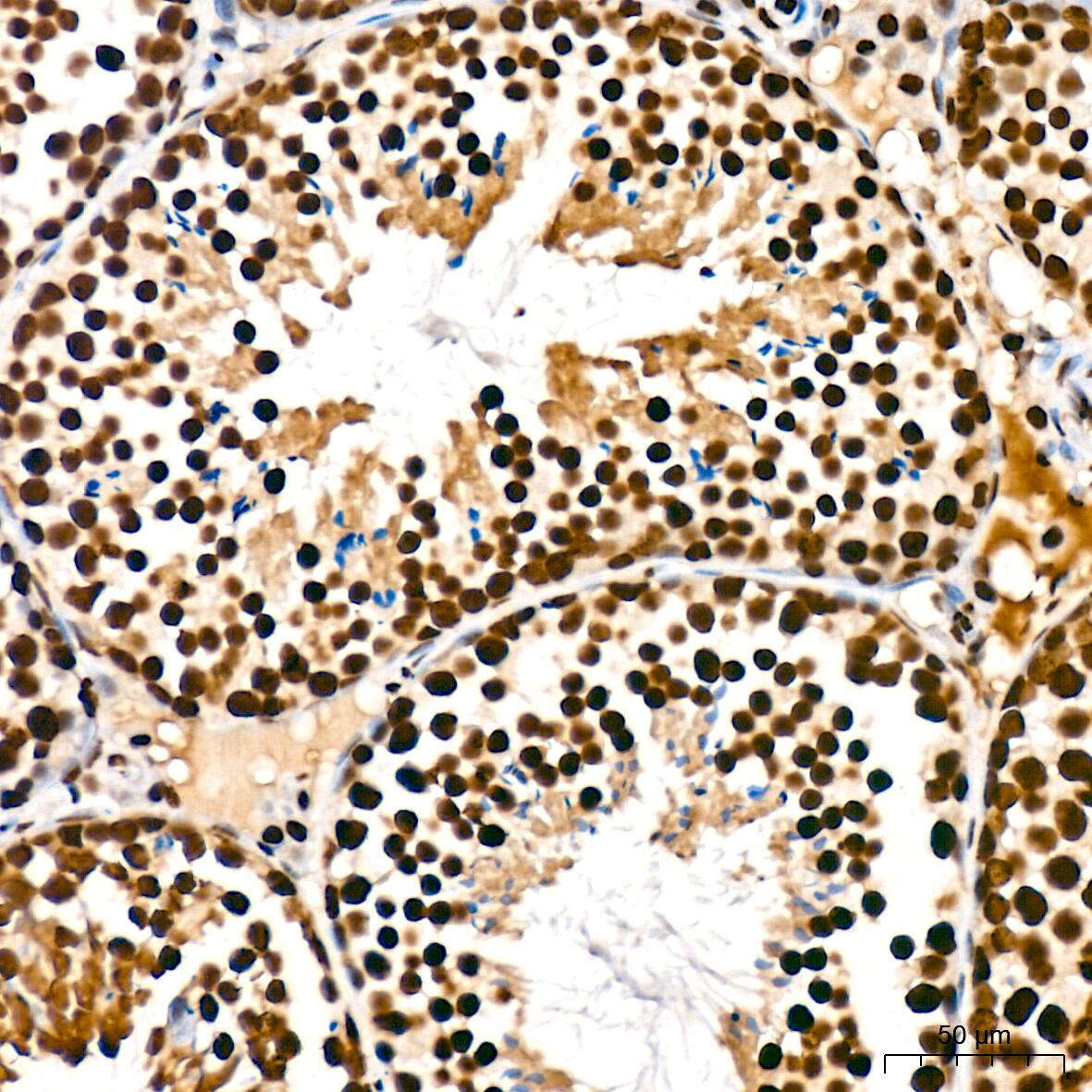 SAP130 Antibody (3K1X4)