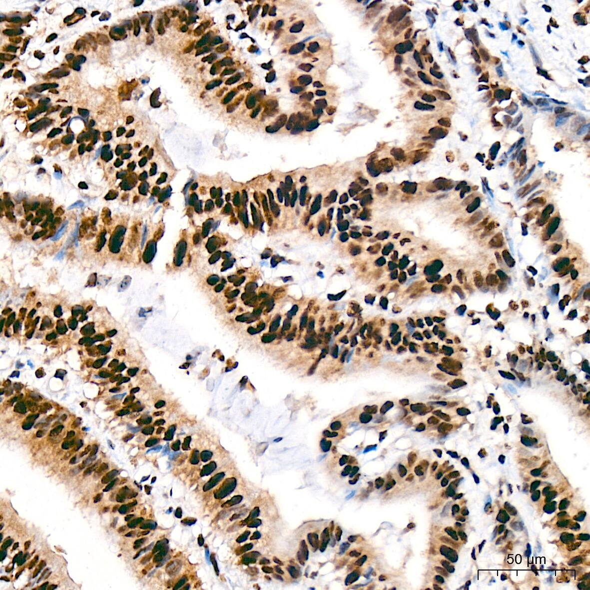 SAP130 Antibody (3K1X4)