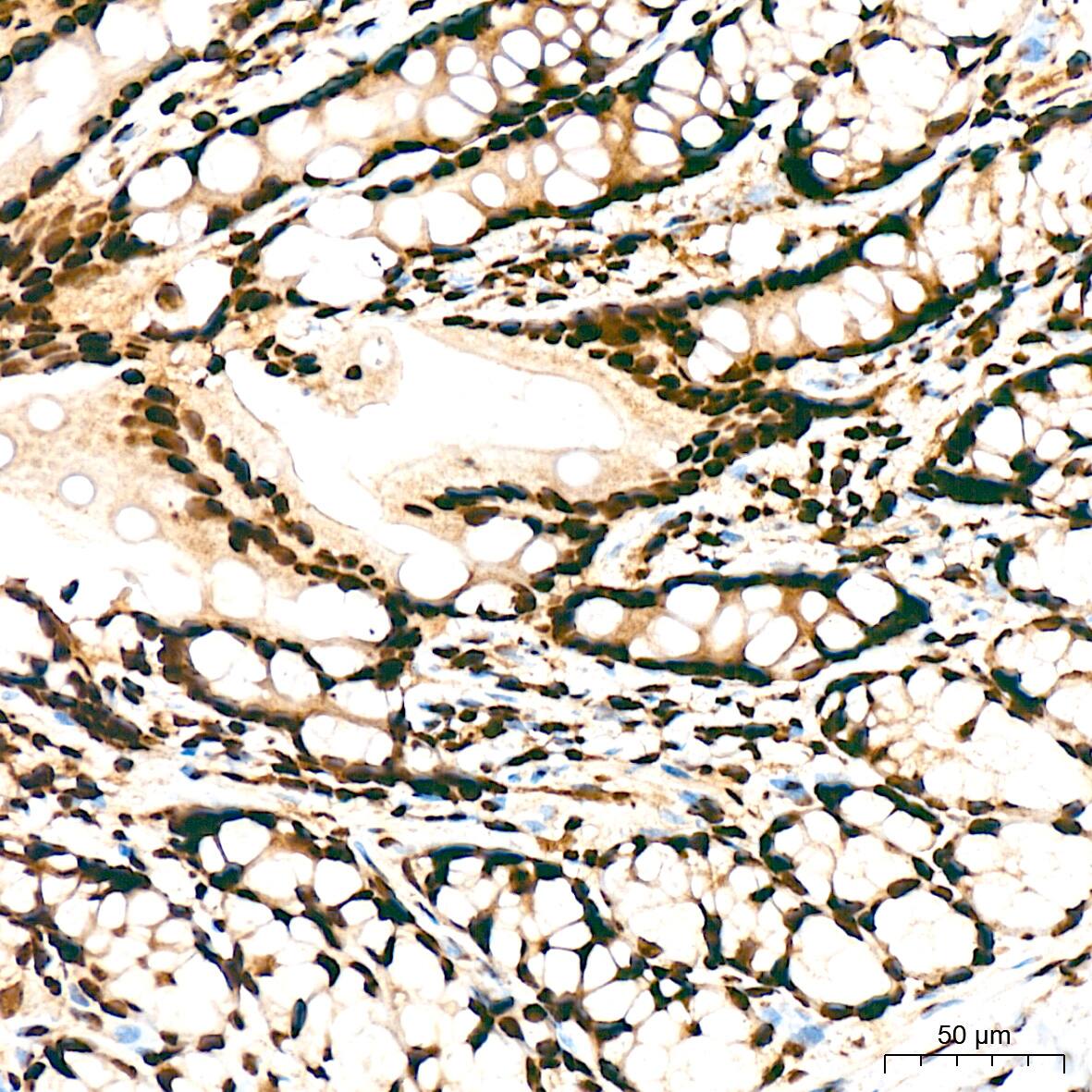 SAP130 Antibody (3K1X4)