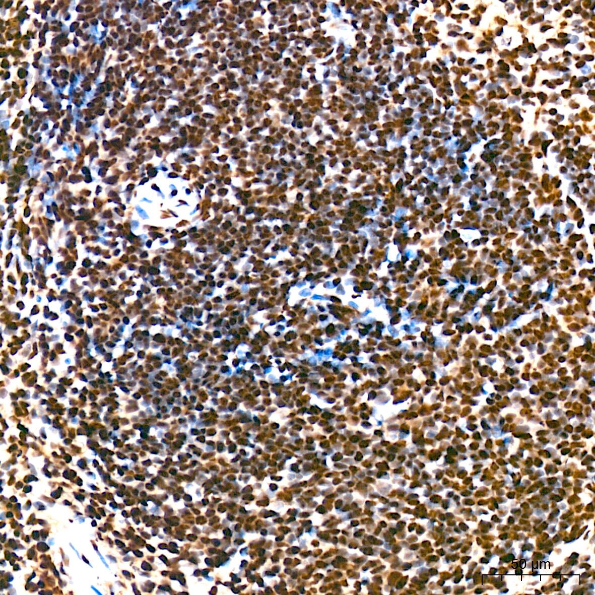 SAP130 Antibody (3K1X4)