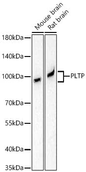 PLTP Antibody (6A1Q1)
