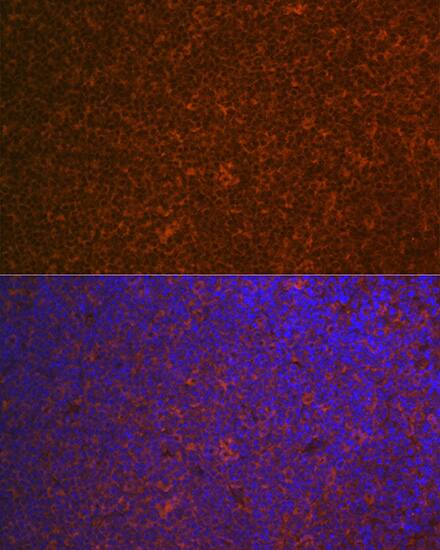 CARD11/CARMA1 Antibody (8N4C9)