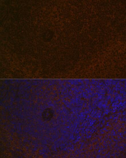 CARD11/CARMA1 Antibody (8N4C9)