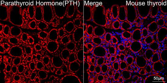 PTH Antibody (5X6R6)