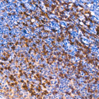 eIF2A Antibody (8V8H7)