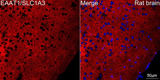 EAAT1/GLAST-1/SLC1A3 Antibody (7Y4U5)