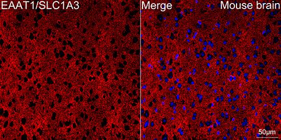 EAAT1/GLAST-1/SLC1A3 Antibody (7Y4U5)