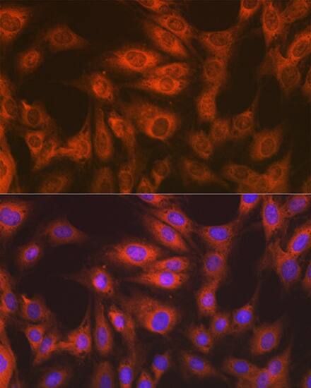 eEF-2 Antibody (4E2Z5)