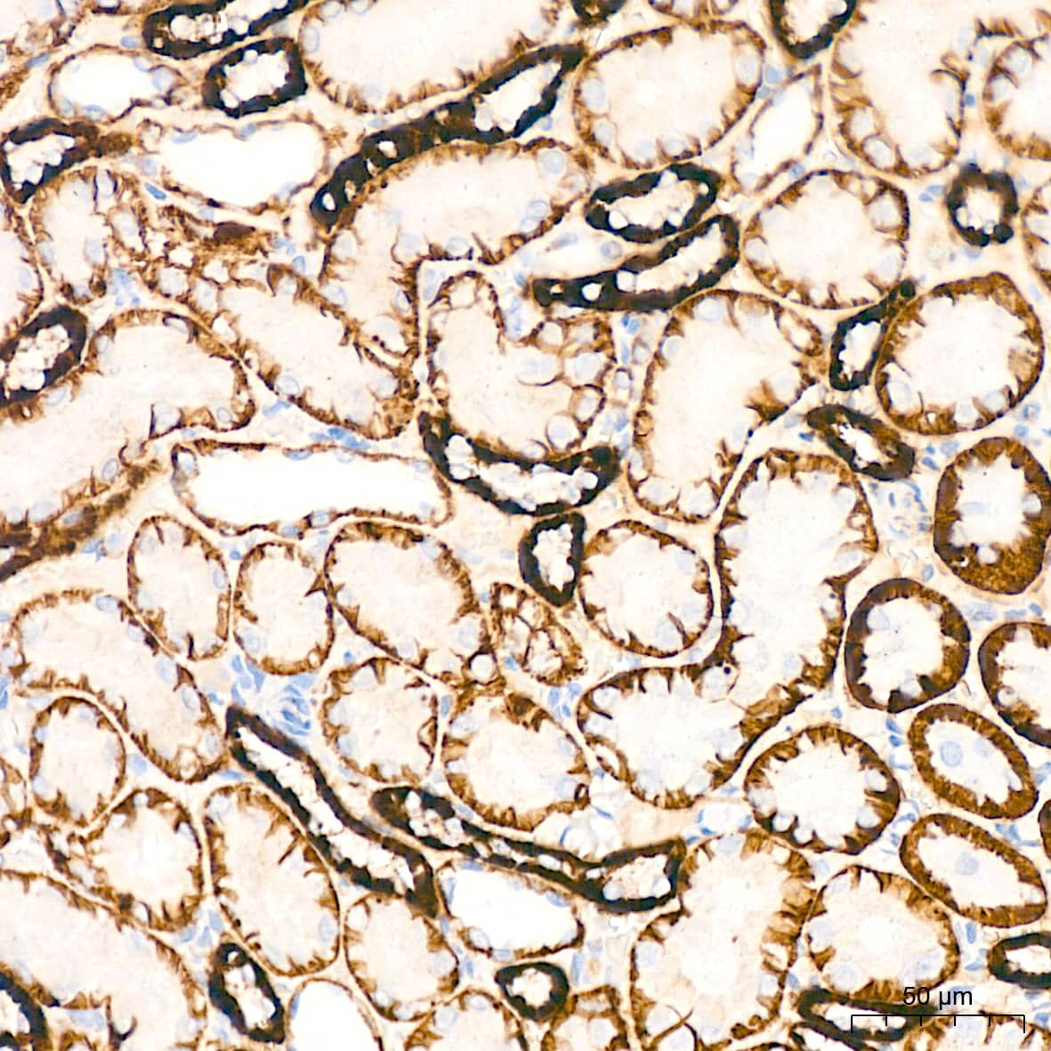 Glutamate Receptor 6 Antibody (4B4L9)